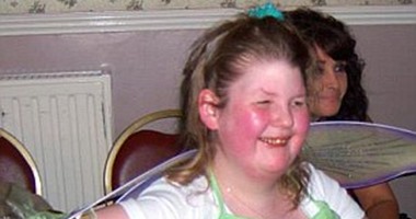 بالصور.. فتاة بريطانية أكلت نفسها حتى الموت بسبب مرض نادر