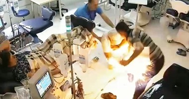 بالفيديو.. رجل يحرق مريضا أثناء غسيل الكلى فى مستشفى العاصمة بألبانيا