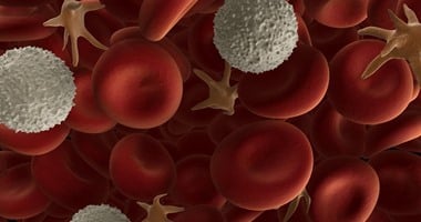 اكتشاف دواء لالتهاب المفاصل يعالج سرطان الدم