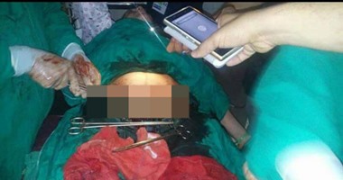 "صحافة المواطن":بالصور.. عملية جراحية على أضواء الموبايل بمستشفى كفر الشيخ