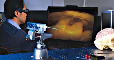 ناسا تطور أصغر كاميرا 3D فى العالم للمساعدة فى نجاح جراحات المخ