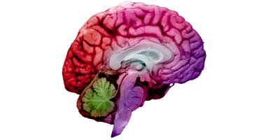 مؤتمر أمريكى يكشف عن أحدث علاج لجلطات المخ بـ"المغناطيس"