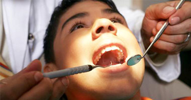 دراسة: التخدير الموضعى لأسنان الأطفال يمنع ظهور ضروس العقل لديهم