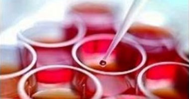 للتقليل من استخدام المضادات الحيوية.. اكتشاف اختبار دم جديد يشخص مرضك