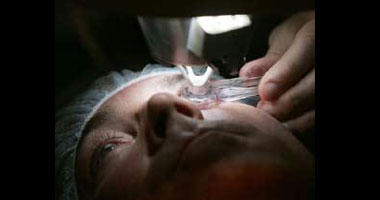 تقنية جديدة لعلاج عتامة العين وأمراض القرنية باستخدام الليزر