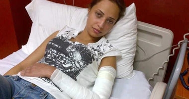 راندا حافظ تلغى حفلها بالإسكندرية بسبب إصابة ذراعها