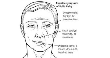 اكتشاف وظائف جديدة لعقار "Parkinson's Disease" لعلاج الشلل الرعاش 