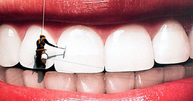هل تعانى من مشكلة تلون الأسنان؟