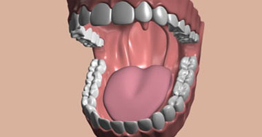 تعرف على أمراض الأسنان التى تسبب آلاما تؤثر على الوجه والمخ 