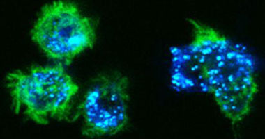 اكتشاف جديد يحول الخلايا "الصديقة" للسرطان إلى "عدو" يقتلها