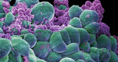 دراسة: الخلايا الليمفاوية قادرة على قتل الخلايا السرطانية بالجسم 