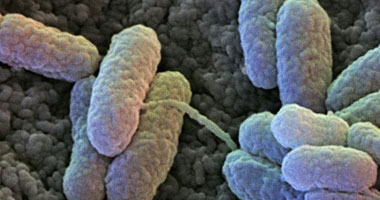 ماذا تعرف عن بكتيريا السالمونيلا وما هى طرق الوقاية اللازمة؟