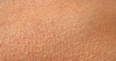 ما هى أسباب التهاب الجلد التماسى؟