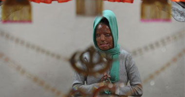 بالصور.."المرأة بلا وجه" تفوز بجائزة المليونير وتلقب بالهندية الأكثر شهرة2012