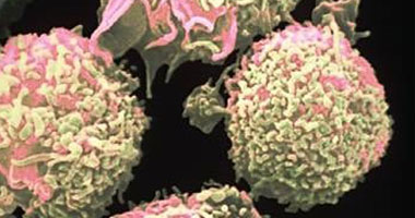 دراسة: فيروس الورم الحليمى البشرى يسبب سرطان الفم والبلعوم