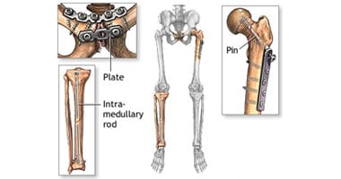ما أنواع العظام بجسم الإنسان؟