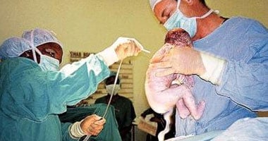 دراسة طبية: 5 عمليات ولادة قيصرية متتالية تهدد حياة المرأة وتعرضها لمضاعفات خطيرة