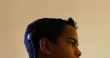 مفاجأة.. أستاذ أنف وأذن: 16% من الأطفال المصريين يعانون ضعف السمع