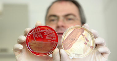 وفاة شخصين وإصابة 5 بالبكتيريا المقاومة للمضادات الحيوية فى أمريكا