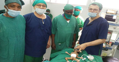 فريق جراحة الأطفال بالإسكندرية يغادر تنزانيا بعد إجراء 20 عملية جراحية