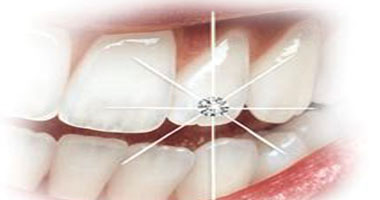 استخدام الليزر فى مجال طب الأسنان بدون حقن تخدير