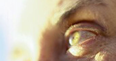 كيف تتجنب التهاب جفون العين؟