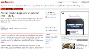 مسح بسيط للمخ يحدد المصابين بالتوحد