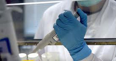 علماء: اكتشاف علاج لفيروس الإيدز من حيوان اللاما.. قريبا