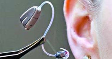 أستاذ أنف وأذن: استخدام السماعة العظمية لضعاف السمع يعطى صوتا أوضح