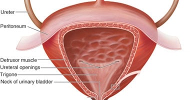 السلس البولى يحدث نتيجة جرح فى المثانة أو الحالب أثناء جراحات النساء