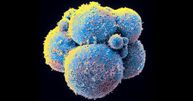 الخلايا الجذعية تعالج الأمراض المستعصية بالمنوفية 