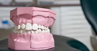 4 أنواع من تركيبات الأسنان الثابتة أبرزها الـ"Veneer" للتجميل