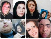 نشطاء يتداولون صورة لإيرانيات استهدفن برش "ماء النار" لعدم ارتدائهن الحجاب