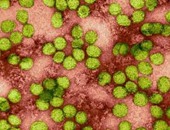لجنة الفيروسات: منح مرضى فيروس سى المنتكسين عقار الدكلانزا نوفمبر المقبل