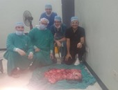 استئصال ورم يزن 45 كيلو من بطن مريض فى مستشفى الأورام بجامعة المنصورة