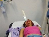سكين يخترق رأس برازيلية دون تأثير على قواها العقلية