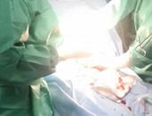 جراحة دقيقة بالصدر لطفل بـ"طوارئ" مستشفى العامرية