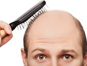 أسباب الصلع وتساقط الشعر أهمها استخدام الجل
