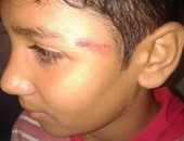 التحقيق مع معلمة تعدت على طالب بضربه على وجهه فى كفر الشيخ