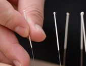 علاج التهاب الشعب الهوائية المزمنة بالوخز بالإبر الصينية