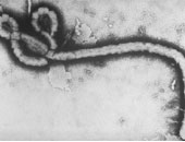 دراسة: فيروس الإيبولا يبقى فى السائل المنوى للناجين من المرض لعدة أشهر