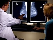 باحثون أمريكيون يتوصلون لبرنامج كمبيوتر يتنبأ بسرطان الثدى
