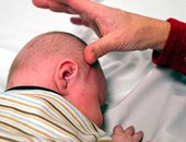 دراسة أمريكية: إصابات الرأس فى الصغار تسبب الوفاة المبكرة