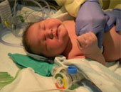 امرأة تلد أكبر طفل وزنه "15" كيلو جراماً بأمريكا 