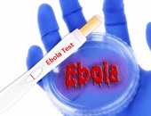 "نيوز ماكس هيلث": اختبار حديث يكشف عن الإيبولا فى غضون 15 دقيقة