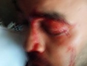 بالصور.. إصابة محامٍ على يد حرس محكمة شبرا الخيمة..وزملاؤه: لازم ناخد حقنا
