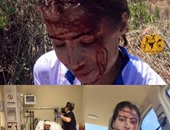 بالصور.. إصابة ابتسام زايد لاعبة الدراجات فى معسكر جنوب أفريقيا
