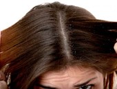 طرق طبيعية للتخلص من قشرة الشعر فى الشتاء أهمها استخدام الخل