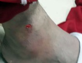 عبد الكافى رجب ينشر صورة لـ"قدم" سعد سمير بعد الإصابة