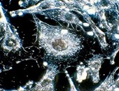 موقع بريطانى:باحثون أمريكيون يتوصلون لطريقة قتل الخلايا السرطانية(تحديث)